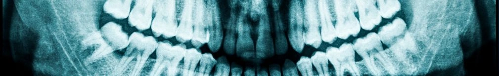 Radiografía ATM - Clínica Dental Lucas