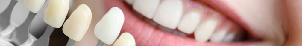 Cosmética Dental - Clínica Dental Lucas