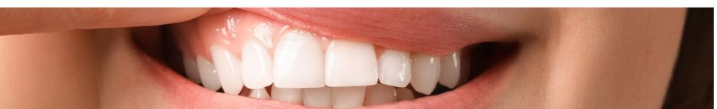 Encías tratamiento y prevención Clínica Dental Lucas